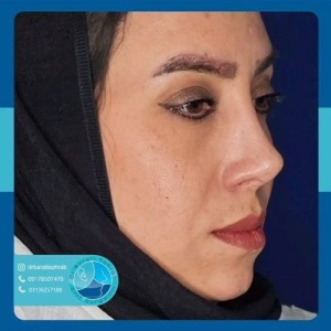 عمل-بینی-47