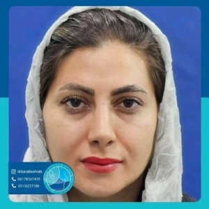 عمل-بینی-48