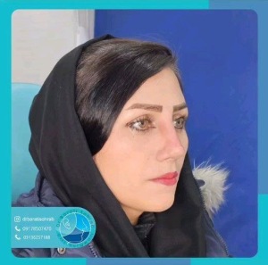 عمل-بینی-49