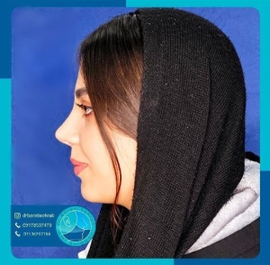 عمل-بینی-50