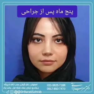 عمل-بینی-51