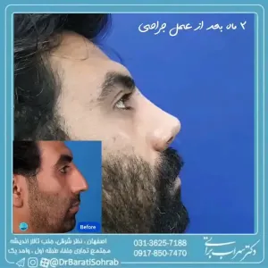 عمل-بینی-53