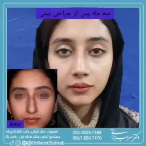 عمل-بینی-54
