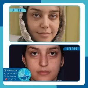 عمل-بینی-55