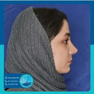 عمل-بینی-56