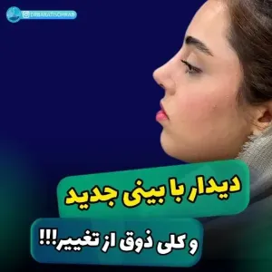 SaveClip.rhinoplasty-75