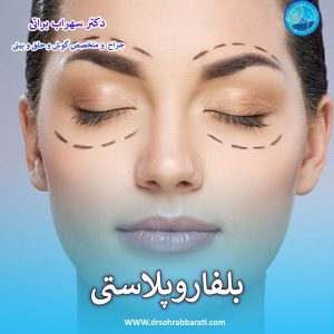 بلفاروپلاستی پلک بالا و پایین - دکتر سهراب براتی 