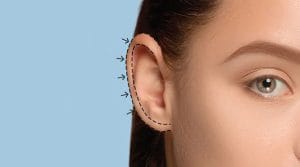 اتوپلاستی در اصفهان _ دکتر سهراب براتی