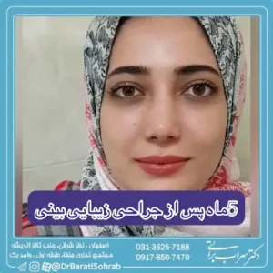 جراحی زیبایی بینی در اصفهان دکتر سهراب براتی