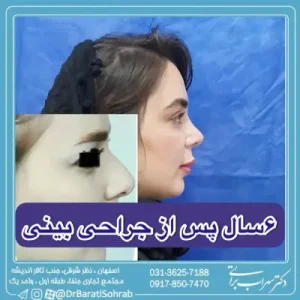 عمل زیبایی بینی در اصفهان دکتر سهراب براتی
