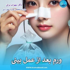ورم بعد از عمل بینی _ دکتر سهراب براتی-drsohrabbarati.com