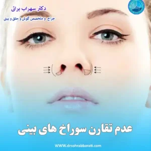 عدم تقارن سوراخ های بینی بعد از عمل _ دکتر سهراب براتی