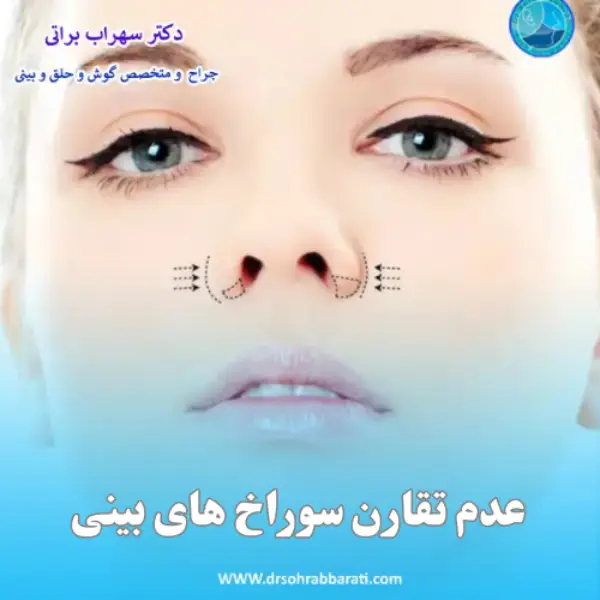 عدم تقارن سوراخ های بینی بعد از عمل _ دکتر سهراب براتی