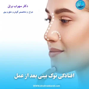 افتادگی نوک بینی بعد از جراحی _ دکتر سهراب براتی