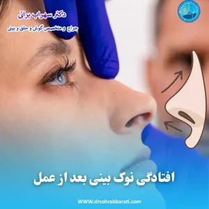 افتادگی نوک بینی بعد از عمل _ دکتر سهراب براتی