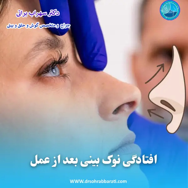 افتادگی نوک بینی بعد از عمل _ دکتر سهراب براتی