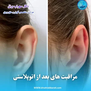 مراقبت های بعد از اتوپلاستی _ دکتر سهراب براتی