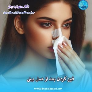 فین کردن بعد از عمل بینی - دکتر سهراب براتی - drsohrabbarati.com