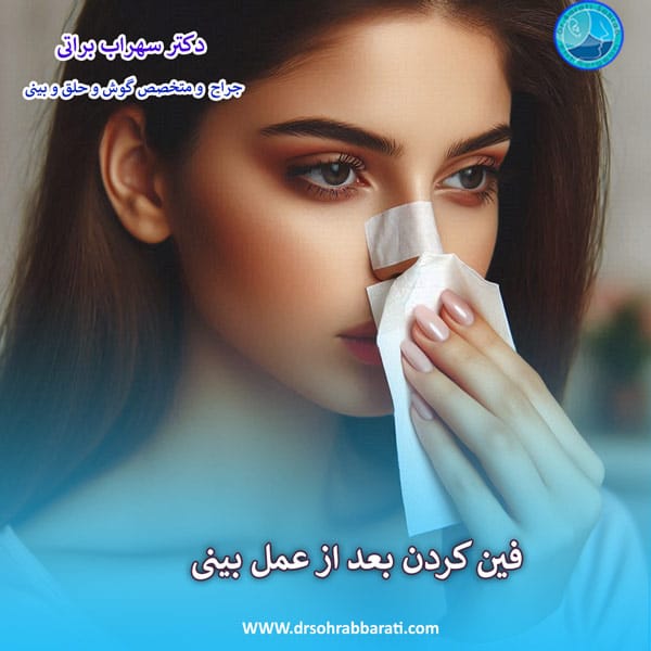 فین کردن بعد از عمل بینی - دکتر سهراب براتی - drsohrabbarati.com